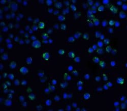 Invitrogen IL21R Polyclonal Antibody 100 &mu;g; Unconjugated:Antibodies,