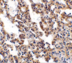 Invitrogen IL21R Polyclonal Antibody 100 &mu;g; Unconjugated:Antibodies,