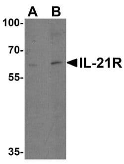 Invitrogen IL21R Polyclonal Antibody 100 &mu;g; Unconjugated:Antibodies,