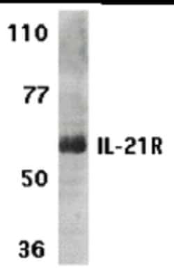 Invitrogen IL21R Polyclonal Antibody 100 &mu;g; Unconjugated:Antibodies,