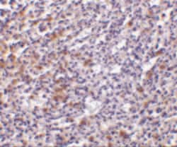 Invitrogen TCCR Polyclonal Antibody 100 &mu;g; Unconjugated:Antibodies,