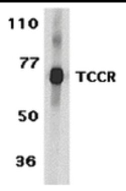 Invitrogen TCCR Polyclonal Antibody 100 &mu;g; Unconjugated:Antibodies,