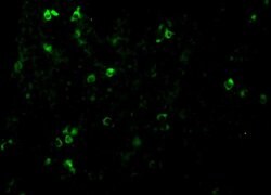 TCCR Polyclonal Antibody:Antibodies, Polyclonal