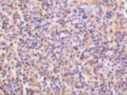 TCCR Polyclonal Antibody:Antibodies, Polyclonal