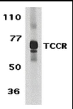 TCCR Polyclonal Antibody:Antibodies, Polyclonal