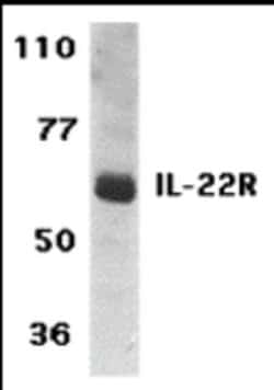 Invitrogen IL-22 Receptor alpha Polyclonal Antibody 100 &mu;g | Buy Online | Invitrogen&trade; | Fisher Scientific