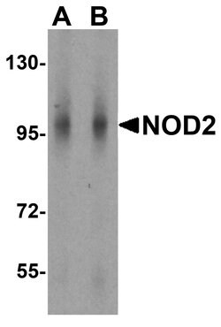 Invitrogen NOD2 Polyclonal Antibody 100 &mu;g; Unconjugated:Antibodies,