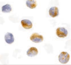 Invitrogen CARD9 Polyclonal Antibody 100 &mu;g | Buy Online | Invitrogen&trade; | Fisher Scientific