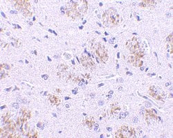 Invitrogen KLHL1 Polyclonal Antibody 100 μg; Unconjugated:Antibodies,