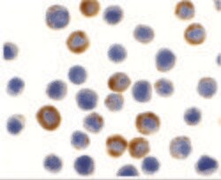 Invitrogen ILP-2 Polyclonal Antibody 100 &mu;g | Buy Online | Invitrogen&trade; | Fisher Scientific