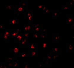 Invitrogen ILP-2 Polyclonal Antibody 100 &mu;g | Buy Online | Invitrogen&trade; | Fisher Scientific