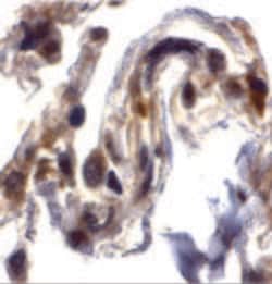 Invitrogen ARTS Polyclonal Antibody 100 &mu;g; Unconjugated:Antibodies,