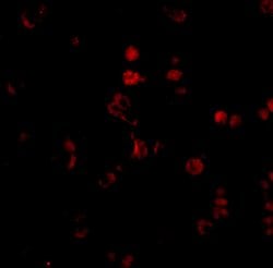 AATF Polyclonal Antibody:Antibodies, Polyclonal