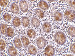 AATF Polyclonal Antibody:Antibodies, Polyclonal