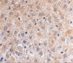 Invitrogen p53DINP1 Polyclonal Antibody 100 &mu;g | Buy Online | Invitrogen&trade; | Fisher Scientific