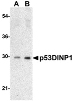 Invitrogen p53DINP1 Polyclonal Antibody 100 &mu;g | Buy Online | Invitrogen&trade; | Fisher Scientific