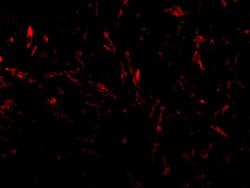 Invitrogen TTC5 Polyclonal Antibody 100 &mu;g | Buy Online | Invitrogen&trade; | Fisher Scientific