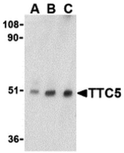 Invitrogen TTC5 Polyclonal Antibody 100 &mu;g | Buy Online | Invitrogen&trade; | Fisher Scientific