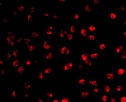Invitrogen AID Polyclonal Antibody 100 &mu;g; Unconjugated:Antibodies,