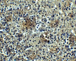 Invitrogen CD268 (BAFF Receptor) Polyclonal Antibody 100 &mu;g | Buy Online | Invitrogen&trade; | Fisher Scientific