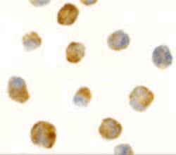 Invitrogen TEM8 Polyclonal Antibody 100 &mu;g | Buy Online | Invitrogen&trade; | Fisher Scientific