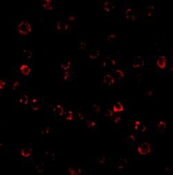 Invitrogen TEM8 Polyclonal Antibody 100 &mu;g | Buy Online | Invitrogen&trade; | Fisher Scientific