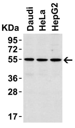 Invitrogen IRAK4 Polyclonal Antibody 100 &mu;g; Unconjugated:Antibodies,