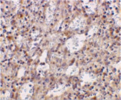 Invitrogen TLR2 Polyclonal Antibody 100 &mu;g; Unconjugated:Antibodies,