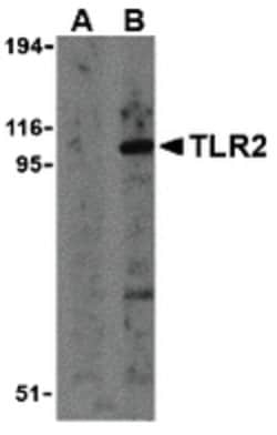 Invitrogen TLR2 Polyclonal Antibody 100 &mu;g; Unconjugated:Antibodies,