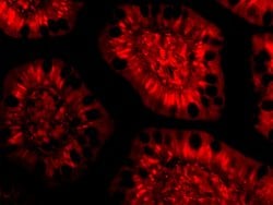 PHAP III Polyclonal Antibody 100 &mu;g | Buy Online | Invitrogen | Fisher Scientific