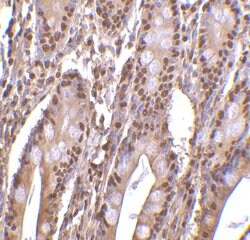 PHAP III Polyclonal Antibody 100 &mu;g | Buy Online | Invitrogen | Fisher Scientific