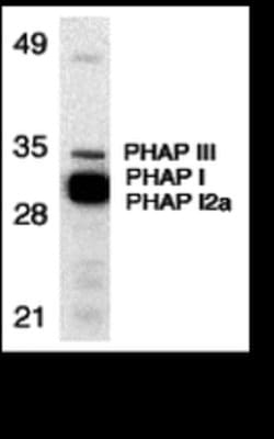 PHAP Polyclonal Antibody:Antibodies, Polyclonal