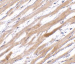 Invitrogen TIRAP Polyclonal Antibody 100 &mu;g; Unconjugated:Antibodies,