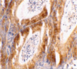 Bcl-G Polyclonal Antibody:Antibodies, Polyclonal