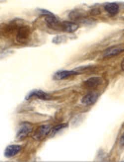 Invitrogen TRIF Polyclonal Antibody 100 &mu;g; Unconjugated:Antibodies,