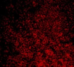 Invitrogen CARD11 Polyclonal Antibody 100 &mu;g; Unconjugated:Antibodies,