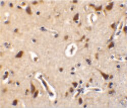 Invitrogen ALS2CR2 Polyclonal Antibody 100 &mu;g; Unconjugated:Antibodies,