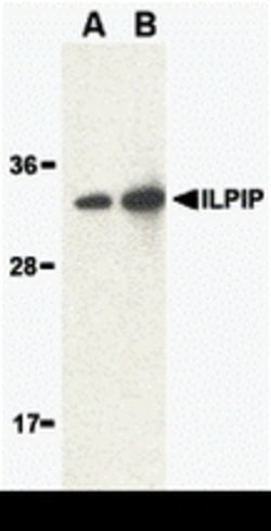 Invitrogen ALS2CR2 Polyclonal Antibody 100 &mu;g; Unconjugated:Antibodies,