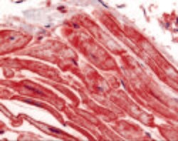 Invitrogen ALS2CR2 Polyclonal Antibody 100 &mu;g | Buy Online | Invitrogen&trade; | Fisher Scientific