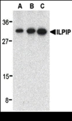 Invitrogen ALS2CR2 Polyclonal Antibody 100 &mu;g | Buy Online | Invitrogen&trade; | Fisher Scientific