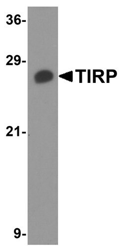TICAM2 Polyclonal Antibody 100 &mu;g | Buy Online | Invitrogen | Fisher Scientific