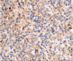 Invitrogen XAF1 Polyclonal Antibody 100 &mu;g; Unconjugated:Anticuerpos