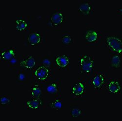 ACE2 Polyclonal Antibody, Invitrogen&trade;