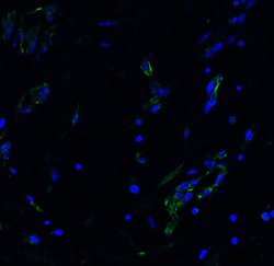 ACE2 Polyclonal Antibody, Invitrogen&trade;