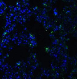ACE2 Polyclonal Antibody, Invitrogen&trade;