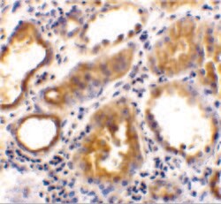 ACE2 Polyclonal Antibody, Invitrogen&trade;