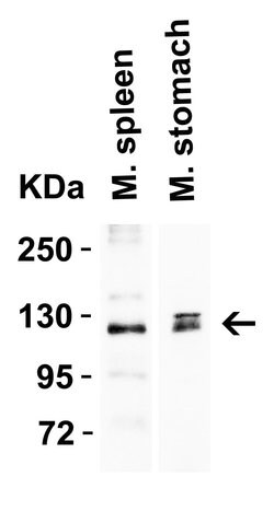 ACE2 Polyclonal Antibody, Invitrogen&trade;