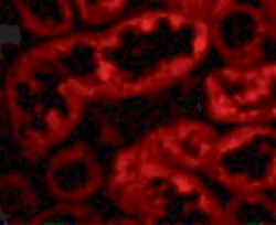 Invitrogen ACE2 Polyclonal Antibody 100 &mu;g; Unconjugated:Antibodies,