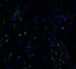 Invitrogen ACE2 Polyclonal Antibody 100 &mu;g; Unconjugated:Antibodies,