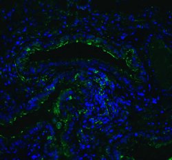 Invitrogen ACE2 Polyclonal Antibody 100 &mu;g; Unconjugated:Antibodies,